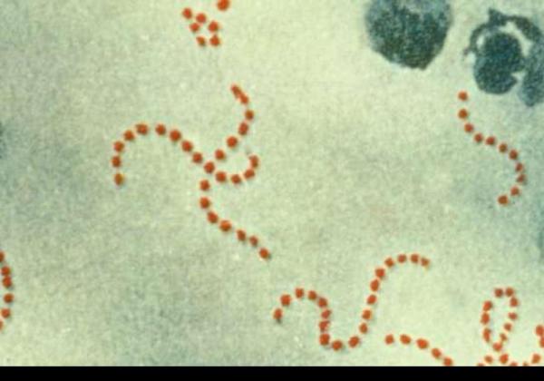 Bakteri Pemakan Daging Streptococcus Landa Jepang, Bagaimana dengan Indonesia?