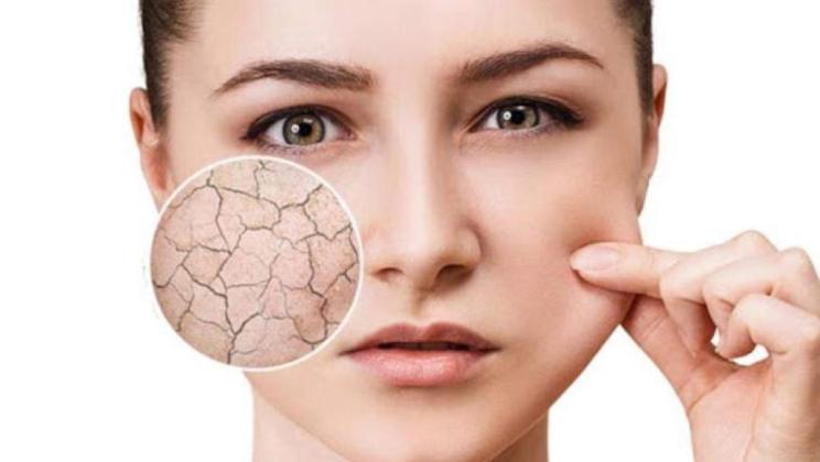 Kandungan Skincare untuk Kulit Kering, Ini Produk dan Bahan yang Harus Anda...