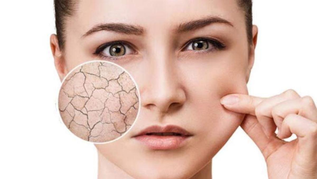 Kandungan Skincare untuk Kulit Kering, Ini Produk dan Bahan yang Harus Anda Cari
