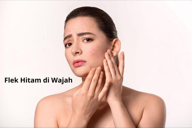 Rahasia Kulit Cerah Bebas Flek Hitam: 5 Perawatan Efektif yang Bisa Dicoba