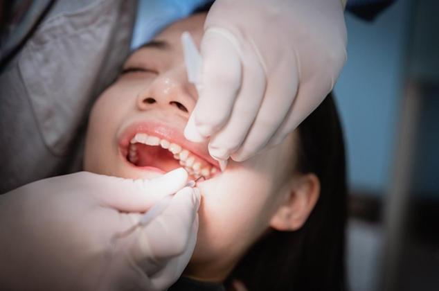 Mitos Cabut Gigi Sebabkan Kebutaan? Ini Penjelasan Dokter Gigi