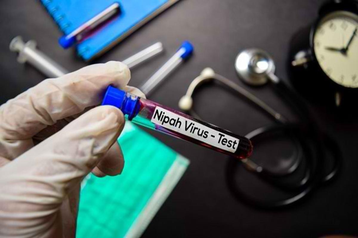 Ancaman Senyap Virus Nipah, Kenali Gejala dan Langkah Pencegahannya Sebelum Terlambat