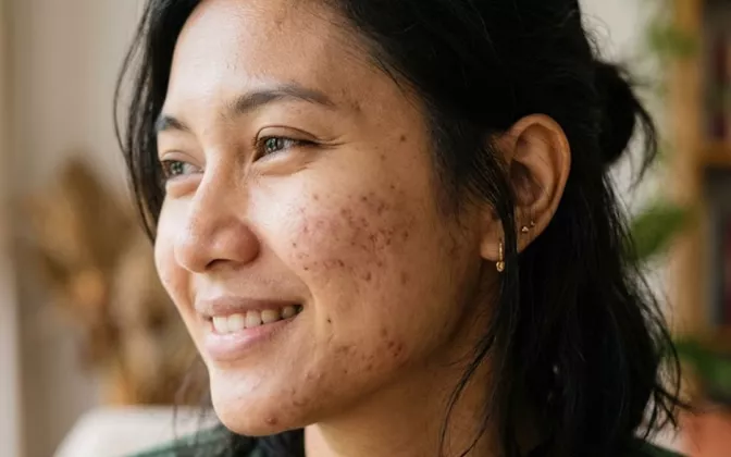 Urutan Skincare Malam untuk Wajah Glowing Bebas Flek Hitam dan Bekas Jerawat